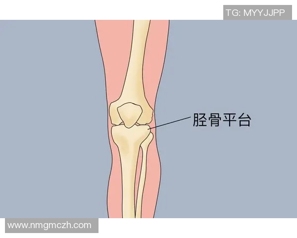 一脚把胫骨踢凹?别慌,咱们把本相说清楚 一脚把胫骨踢凹?别慌,咱们把本相说清楚